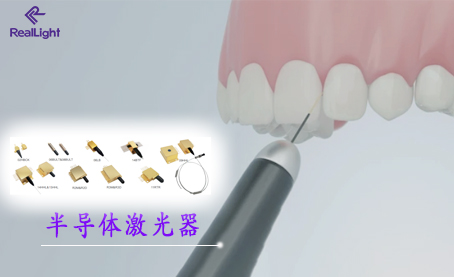 激光口腔治疗